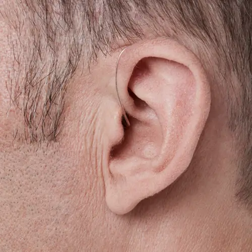 Appareils auditifs micro-contours